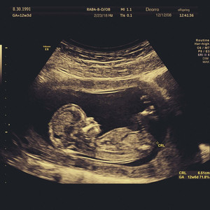 亚洲欧美激情影院
